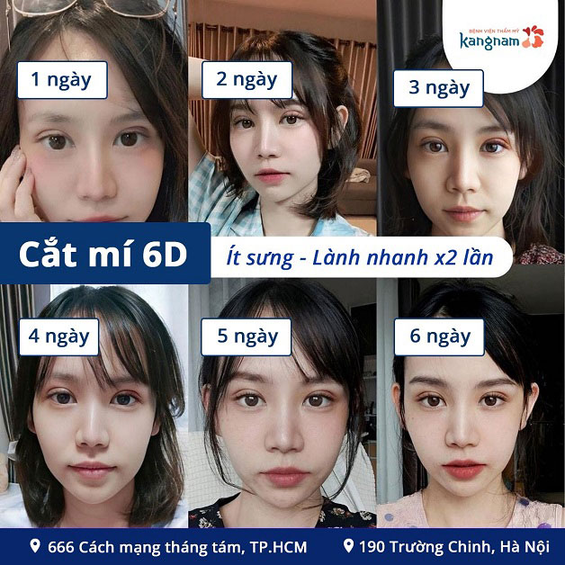 Mắt đẹp tự nhiên, thực hiện chính xác