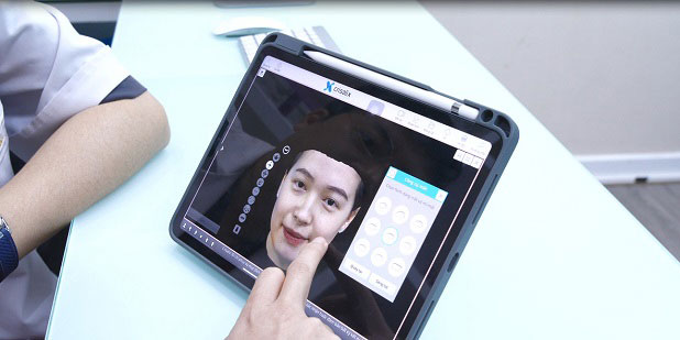 Lựa chọn công nghệ cắt mí