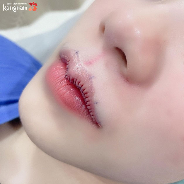 Tạo hình môi trái tim