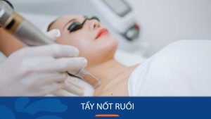 Tẩy Nốt Ruồi Nhanh Chóng – Giá Cực Tốt – Chỉ Có Tại Kangnam