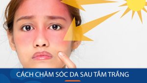 Cách bảo vệ da khỏi tác hại của ánh nắng mặt trời sau khi tắm trắng