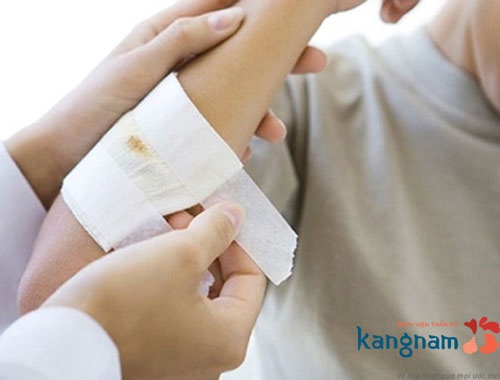 Chế độ chăm sóc sau phẫu thuật cắt sẹo lồi trị sẹo lồi ở tai