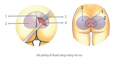 cách làm mông to nhanh nhất