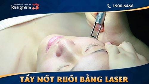 Laser CO2 Fractional mang tới những ưu điểm vượt trội cho khách hàng khi thực hiện xóa nốt ruồi