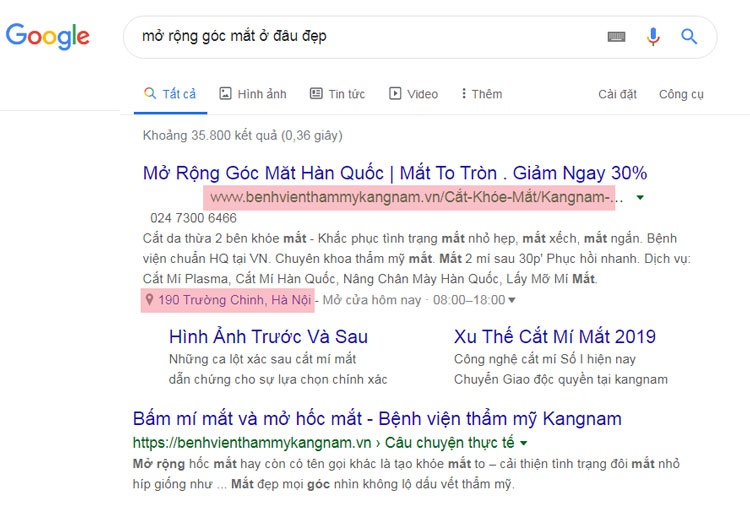 mở rộng khóe mắt ở đâu đẹ Kangnam đứng top đầu kêt quả tìm kiếm địa chỉ mở góc mắt đẹp