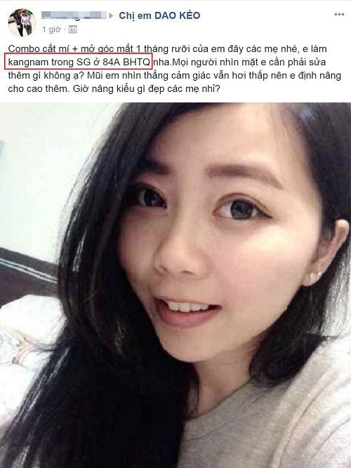 mở rộng hốc mắt ở đâu đẹp Khách hàng chia sẻ cảm nhận sau khi mở rộng hốc mắt