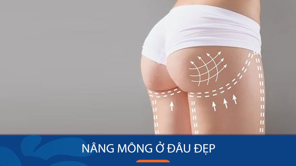 Nâng mông ở đâu đẹp? 3 lưu ý lựa chọn địa chỉ nâng mông