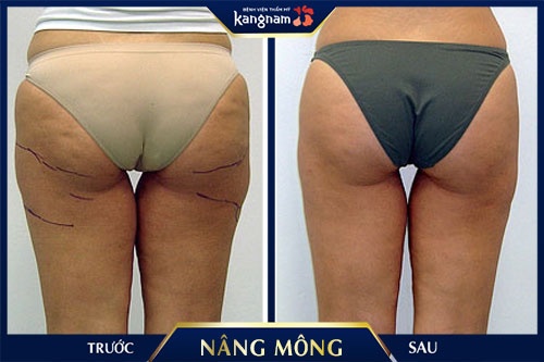 cách làm mông bớt xệ