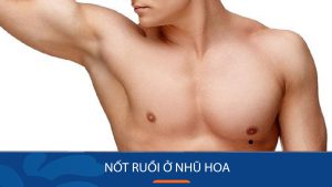 Nốt ruồi ở nhũ hoa: Dấu hiệu may mắn hay vận hạn? Xem ngay để biết!
