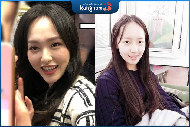 Phụ nữ trán dô rộng có sự thăng tiến vượt bậc trong sự nghiệp, trán bé dô có óc sáng tạo, thấu tình đạt lý