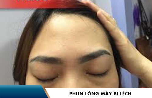 phun lông mày bị lệch