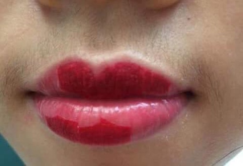 Để môi tự bong vảy theo cơ chế tự nhiên, tránh cạy, bóc sẽ khiến môi bị tổn thương Để môi tự bong vảy theo cơ chế tự nhiên, tránh cạy, bóc sẽ khiến môi bị tổn thương