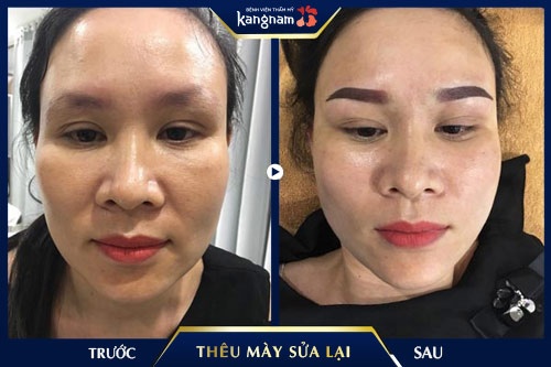 sửa lông mày thêu hỏng