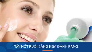 Cách tẩy nốt ruồi bằng kem đánh răng: Hiệu quả hay lừa đảo?