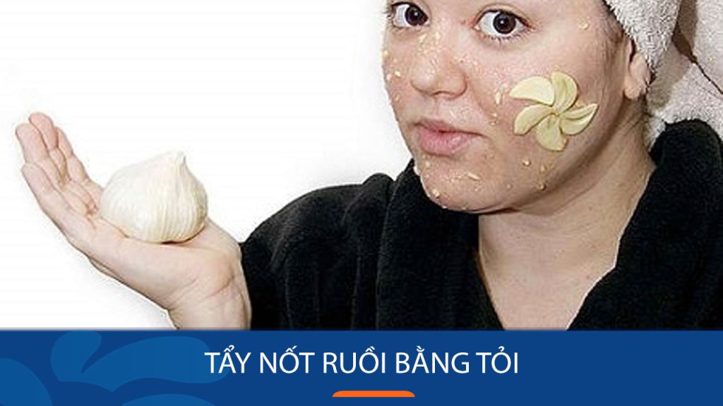 Bí Quyết Tẩy Nốt Ruồi Bằng Tỏi Nhanh Chóng, Mờ Thâm Chỉ Sau 7 Ngày