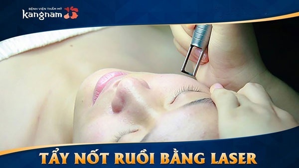 tẩy nốt ruồi ở hà nội giá bao nhiêu tẩy nốt ruồi ở hà nội giá bao nhiêu