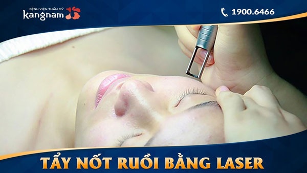 tẩy nốt ruồi không để lại sẹo tẩy nốt ruồi không để lại sẹo