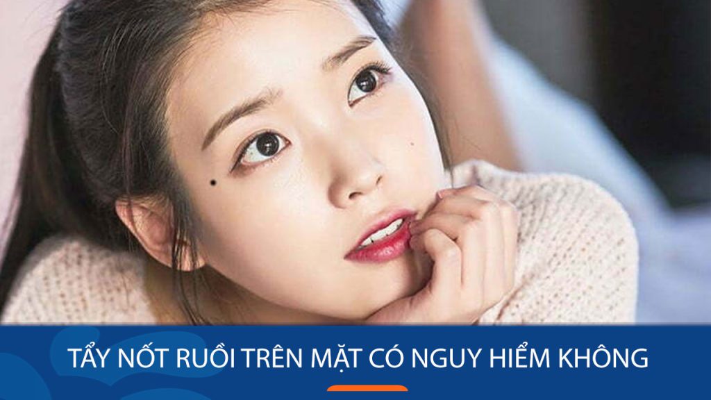 Tẩy nốt ruồi trên mặt có nguy hiểm không? Chuyên gia da liễu giải đáp