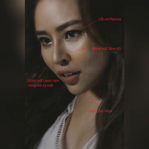 Gương mặt thần thái, xinh đẹp của Thái Bảo Trâm The Voice sau nâng mũi, cắt mí, độn cằm thái bảo trâm the voice