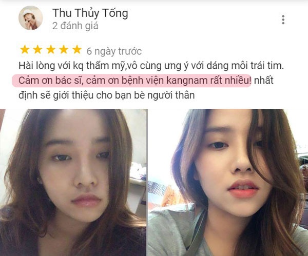 thu gọn môi ở đâu đẹp