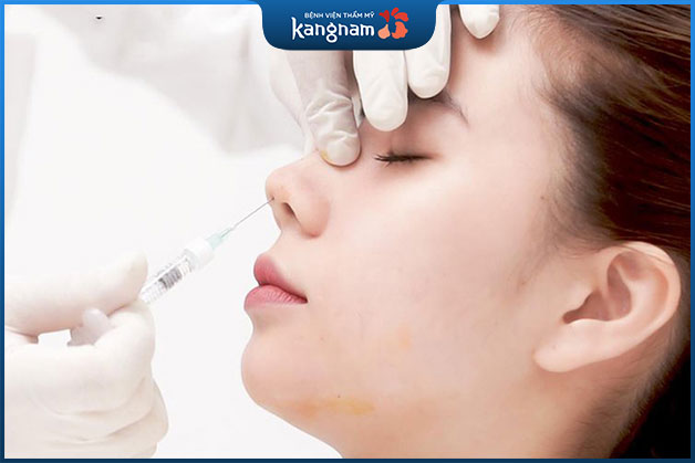 Tiêu chí đánh giá tiêm filler mũi an toàn