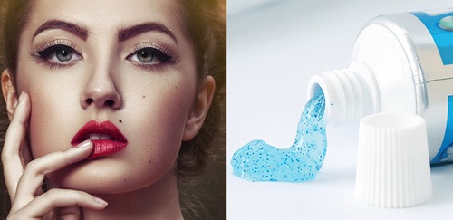 Mẹo xóa nốt ruồi bằng kem đánh răng được nhiều người áp dụng cách tẩy nốt ruồi bằng kem đánh răng