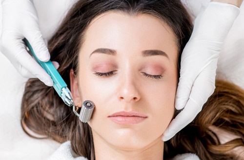 Lăn kim có nhiều ưu điểm vượt trội nhưng cũng không ít nhược điểm