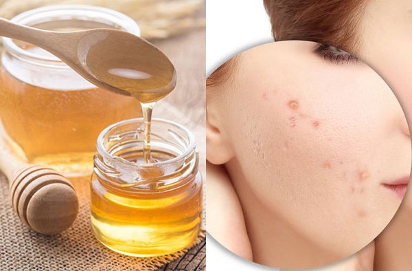 trị sẹo sau khi tẩy nốt ruồi