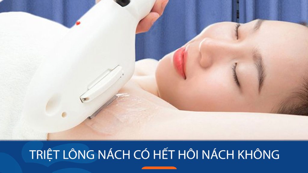 Triệt lông nách có hết hôi nách? Giải đáp từ bác sĩ da liễu