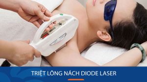 Triệt Lông Nách Diode Laser: An Toàn, Hiệu Quả, Giá Cả Hợp Lý