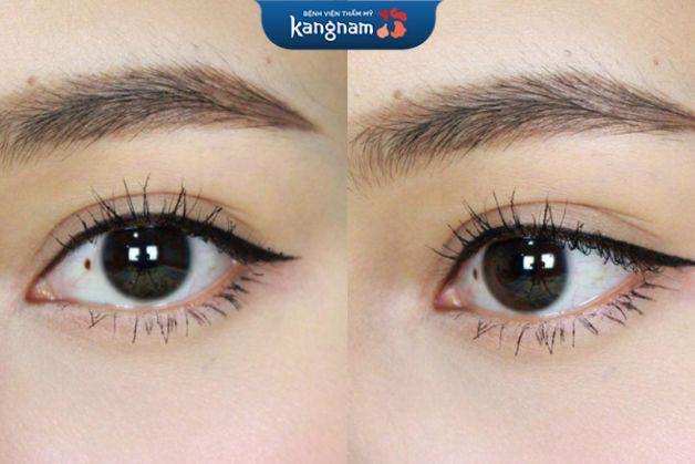 Sau phun mí, đôi mắt trông to tròn long lanh và có hồn hơn