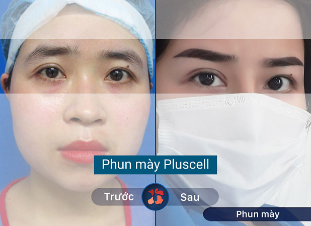 An tâm phun mày tại Kangnam, cải thiện tướng mạo đẹp