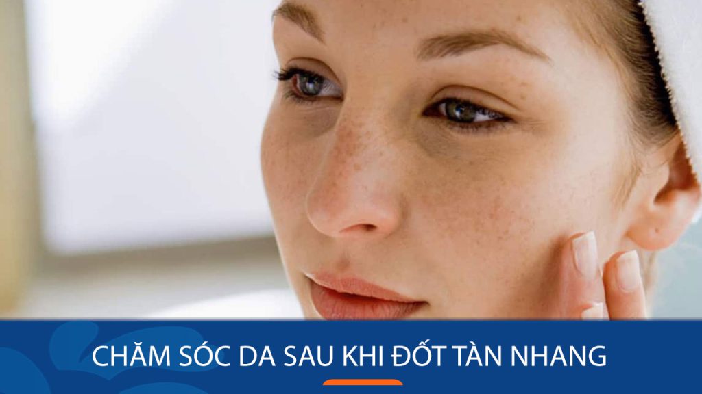 Chăm sóc da sau khi đốt tàn nhang- 5 Lưu ý bắt buộc Phải Nhớ
