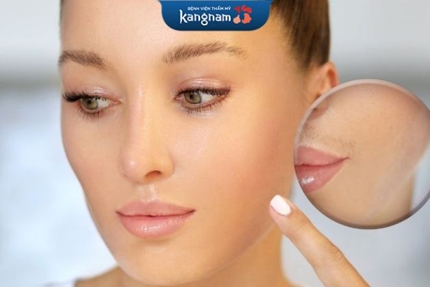 Có nên triệt ria mép không?