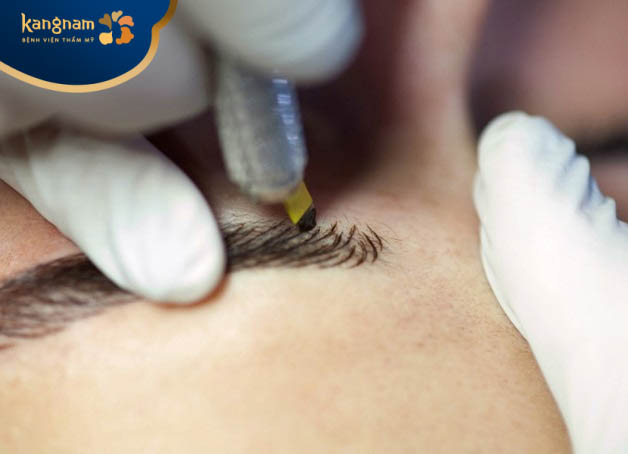 Quy trình điêu khắc thẩm mỹ lông mày chuẩn gồm 5 bước