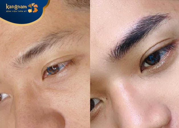 Sau điêu khắc, khách hàng được kĩ thuật nhắc nhở tường tận về dinh dưỡng, chăm sóc khoa học