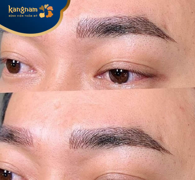 Chỉ sau điêu khắc chân mày nam 1 tháng: lông mày rậm, lên màu tự nhiên