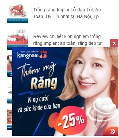 giá trám răng sâu