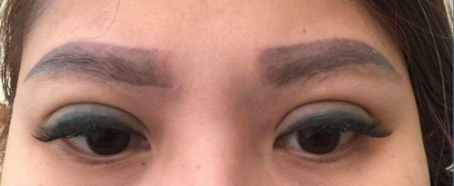 Đường mí to thô, màu mực trổ xanh, loang màu nhanh chóng sau khi thực hiện xăm mí được vài ngày hậu quả xăm mí mắt