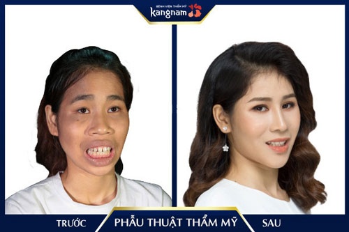 những ca phẫu thuật thẩm mỹ thành công
