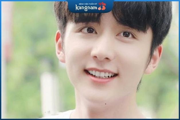 Nốt ruồi nọng cằm nam giới