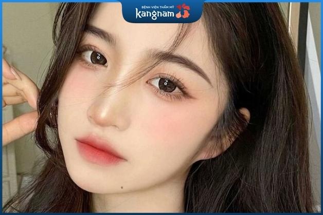 Nốt ruồi ở cằm trái phụ nữ