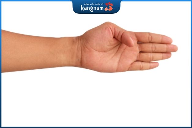 Ý nghĩa nốt ruồi ở vòng cổ tay trên