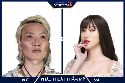 phẫu thuật thẩm mỹ hết bao nhiêu tiền