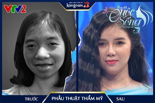 phẫu thuật thẩm mỹ nên hay không