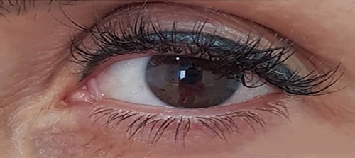 Màu mực kém chất lượng làm tăng nguy cơ viêm nhiễm khi xăm mí mắt cho khách hàng phun mí bị viêm