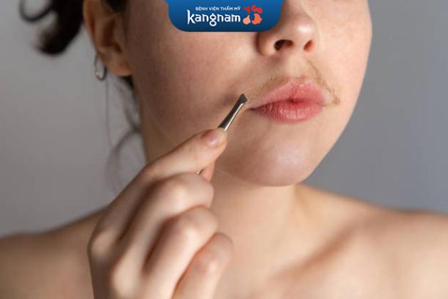 Nếu mẹ có ria mép thì khả năng di truyền cho con cái là rất cao