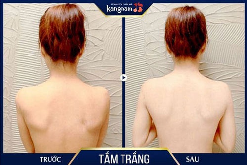 tắm trắng có hại da không