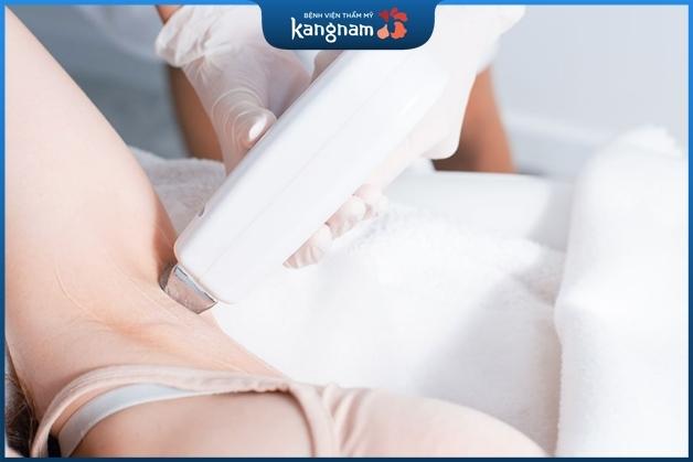 Tẩy nốt ruồi trên nách bằng công nghệ cao