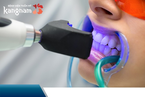 tẩy trắng răng bao nhiêu tiền